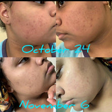 Calendula Lemongrass Facial Soap - Lavished by Nature - by Crystal Marie®